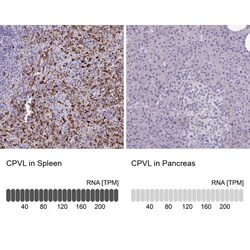 CPVL Antibody, Novus Biologicals:Antibodies:Primary Antibodies